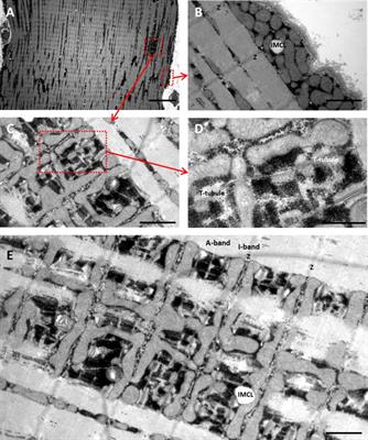 The Muscle Fiber Profiles, Mitochondrial Content, and Enzyme Activities of the Exceptionally Well-Trained Arm and Leg Muscles of Elite Cross-Country Skiers